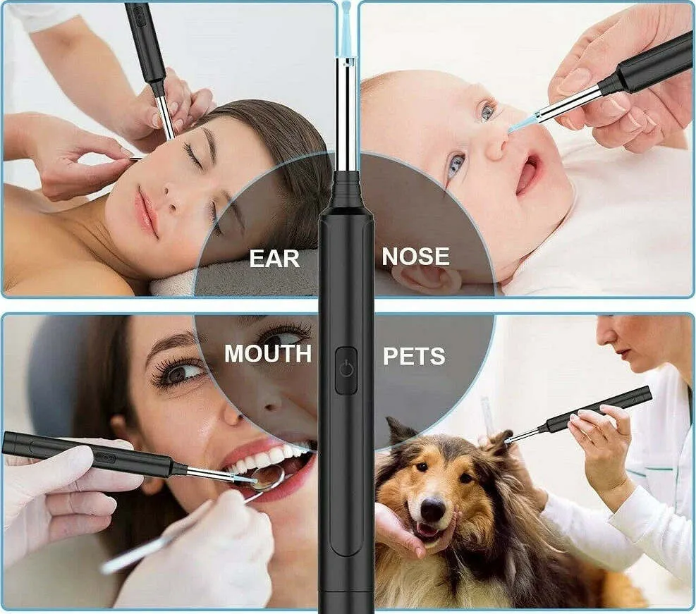 Otoscopio Ispezione Orecchio Kit Rimozione Cerume Wifi Microscopio Camera Q-es1