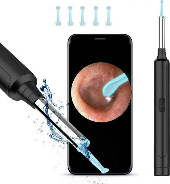 Otoscopio Ispezione Orecchio Kit Rimozione Cerume Wifi Microscopio Camera Q-es1